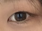 奥二重