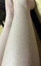 全身の乾燥がひどい