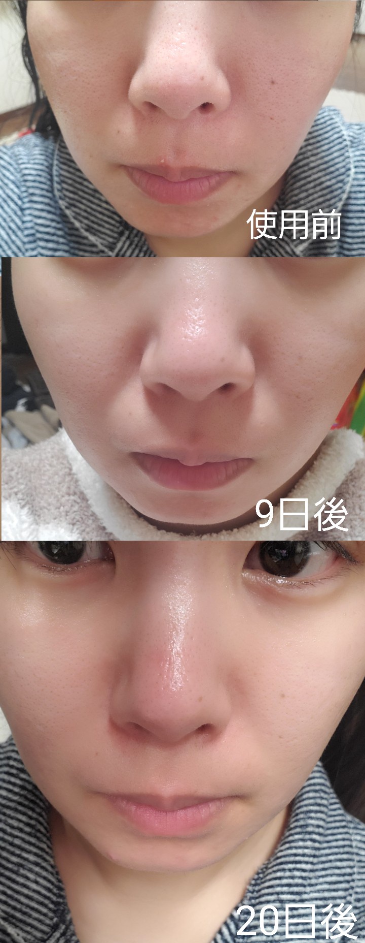 オバジ / オバジC25セラム ネオの口コミ写真（by ゆきぞー。さん 2枚目）｜美容・化粧品情報はアットコスメ