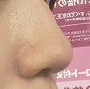 鼻の厚み