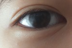 目の下のシワ