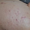 【肌の写真閲覧注意】肌を綺麗にしたいです。