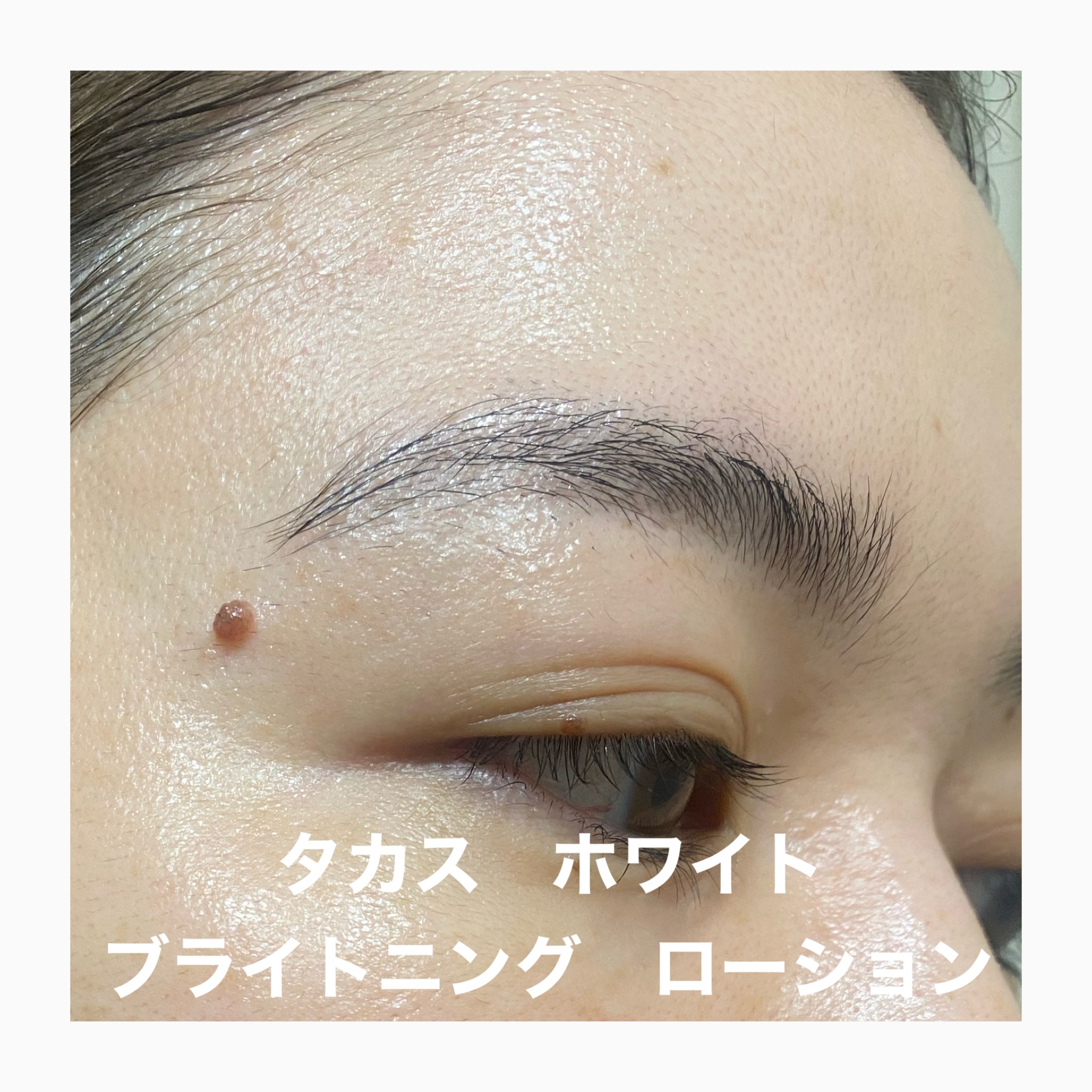 TAKASU WHITE / タカスホワイト ローションの公式商品情報｜美容