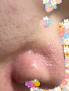 鼻の毛穴