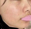 高校生のスキンケア(間違えて解決済にしてしまったためもう一度失礼します)