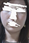 ビニール肌？