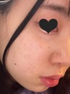 私の顔の弱点を教えてください