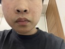 顔の汚れについて