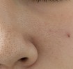 毛穴
