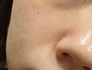 頬の毛穴の繋がり