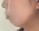 横顔