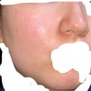 この肌はビタミンかレチノールどちらがいいと思いますか？