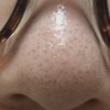 この写真は何毛穴？