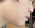 横顔について