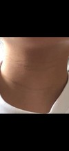 首のシワ