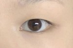 涙袋影ラインや粘膜ライン