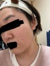 肌を綺麗にする方法