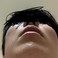 この肌の原因と対処について