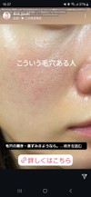スキンケアの組み合わせについて