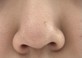 メラニン毛穴？