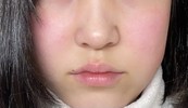 私赤ら顔ですか・・？