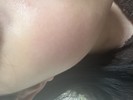 スキンケア