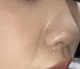 皮脂崩れ？が酷いです ！写真あり！