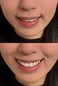 笑うことがコンプレックス