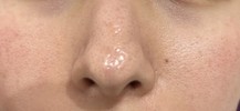 毛穴に効く良いスキンケア教えてください