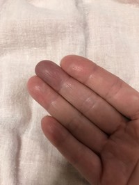 ブラックゲルパック ブラックゲルパックの口コミ一覧 美容 化粧品情報はアットコスメ ブラックゲルパック ブラックゲルパックの口コミ一覧 美容 化粧品情報はアットコスメ