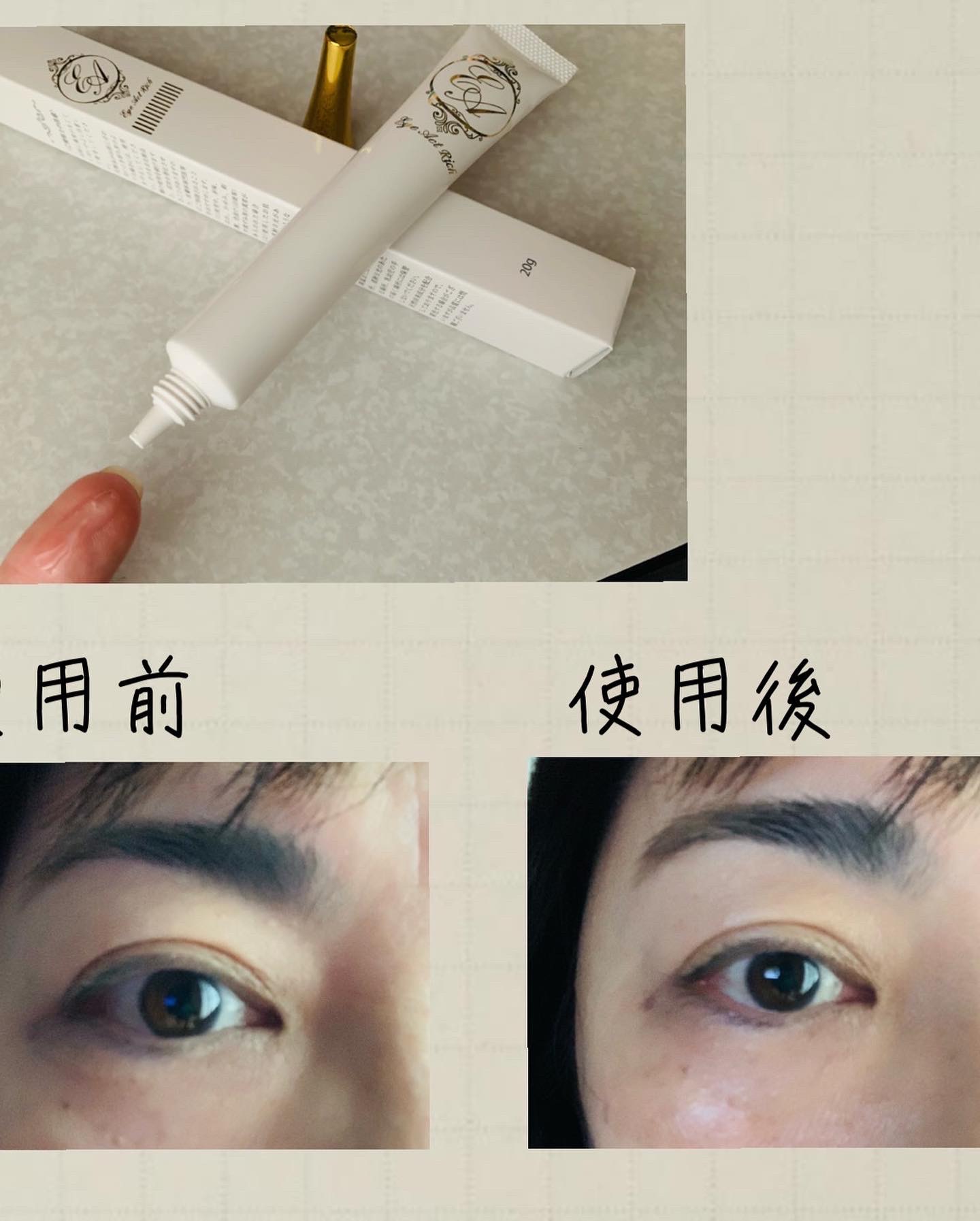 新品未使用【2個セット】アイアクトリッチ アイクリーム 眼瞼下垂20g
