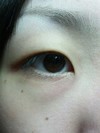 目の下のシワ・・・