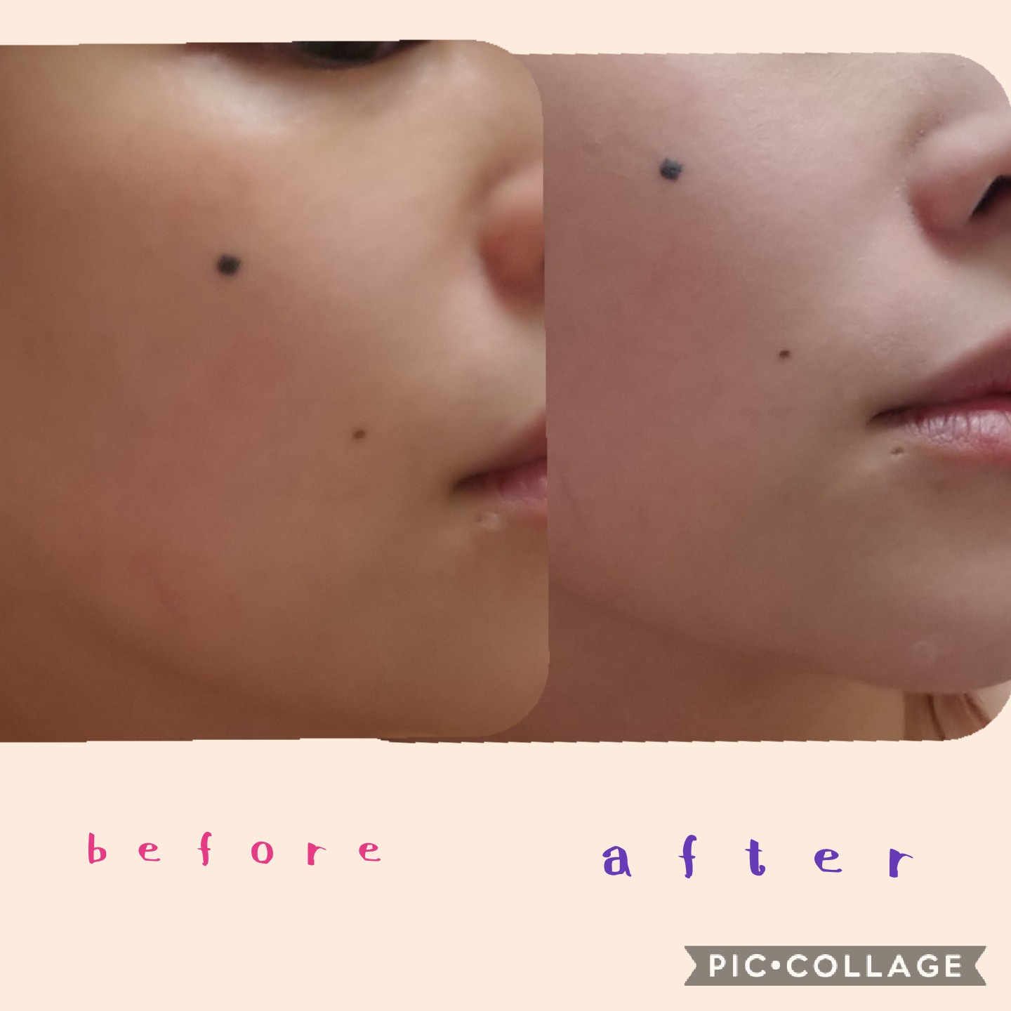 17skin / 高濃度炭酸パックの公式商品情報｜美容・化粧品情報は