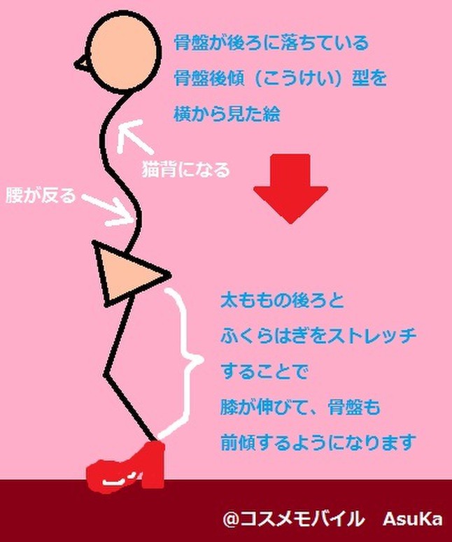 後継 骨盤