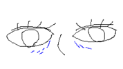 二十歳なのに目の下にシワ・・