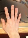 手がしわしわ・・・。どうすればいいのでしょうか？