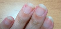 爪を綺麗にしたいのですが、日数と費用はどのくらいかかるでしょうか？