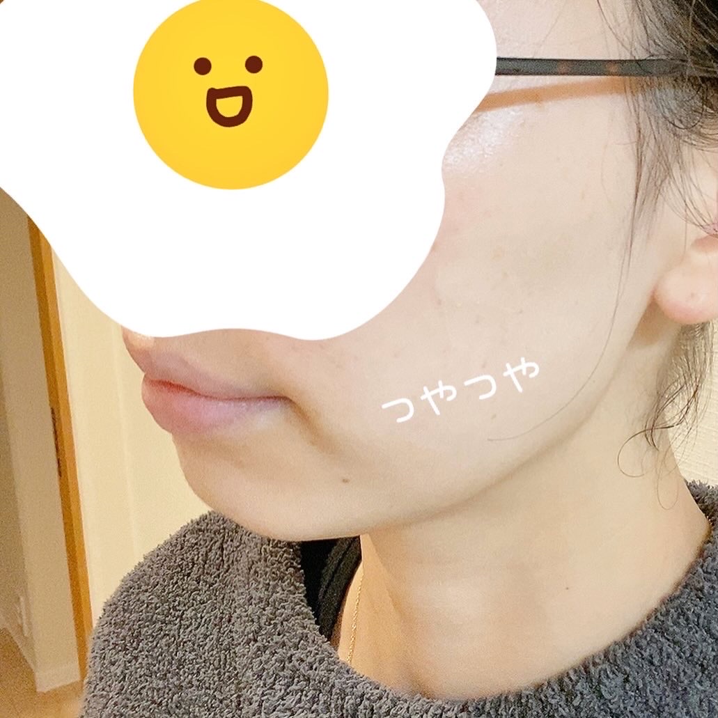 TOLUX / 薬用ホワイトニングフェイスジェルの公式商品情報｜美容