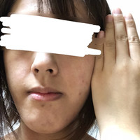 顔と体で肌色が違う 汚い肌で写真写り悪くてすみません Q A Cosme アットコスメ 顔と体で肌色が違う 汚い肌で写真写り悪くてすみません Q A Cosme アットコスメ
