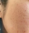 毛穴に効果のある化粧水
