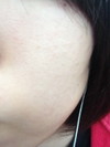 汚すぎる肌(写真)