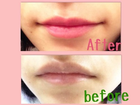 ベリサム My Lip Tint Packの口コミ写真 By 1901ayumiさん 1枚目 美容 化粧品情報はアットコスメ