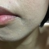 この状態は何と言うのですか？