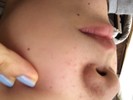 汚すぎる肌