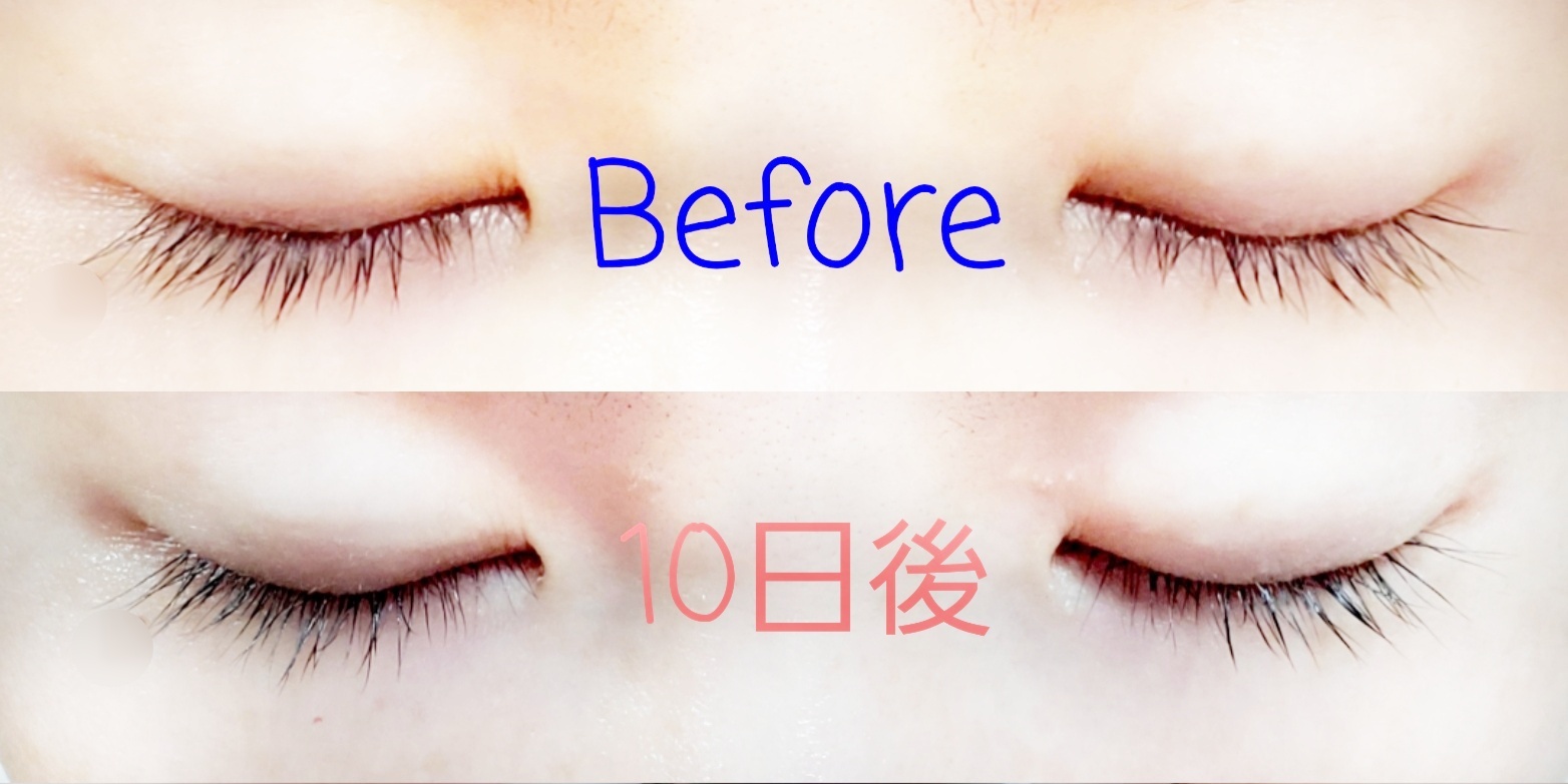 FABIUS / BONNY LASHES(ボニーラッシュ)の口コミ写真（by jang_yoona ...