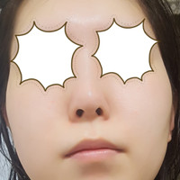 本当に顔が丸い 造顔マッサージを毎朝夕する リン Q A Cosme アットコスメ 本当に顔が丸い 造顔マッサージを毎朝夕する リン Q A Cosme アットコスメ