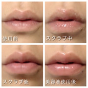 Uha味覚糖 美はお口から研究所リップスクラブの口コミ By Kny0309さん 美容 化粧品情報はアットコスメ Uha味覚糖 美はお口から研究所リップスクラブの口コミ By Kny0309さん 美容 化粧品情報はアットコスメ