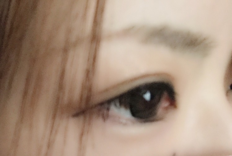 D-UP(ディーアップ) / ワンダーアイリッドテープ 片面タイプの口コミ写真（by ぴーすけ、さん 1枚目）｜美容・化粧品情報はアットコスメ
