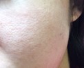 ツルツルなのに毛穴が目立ちます
