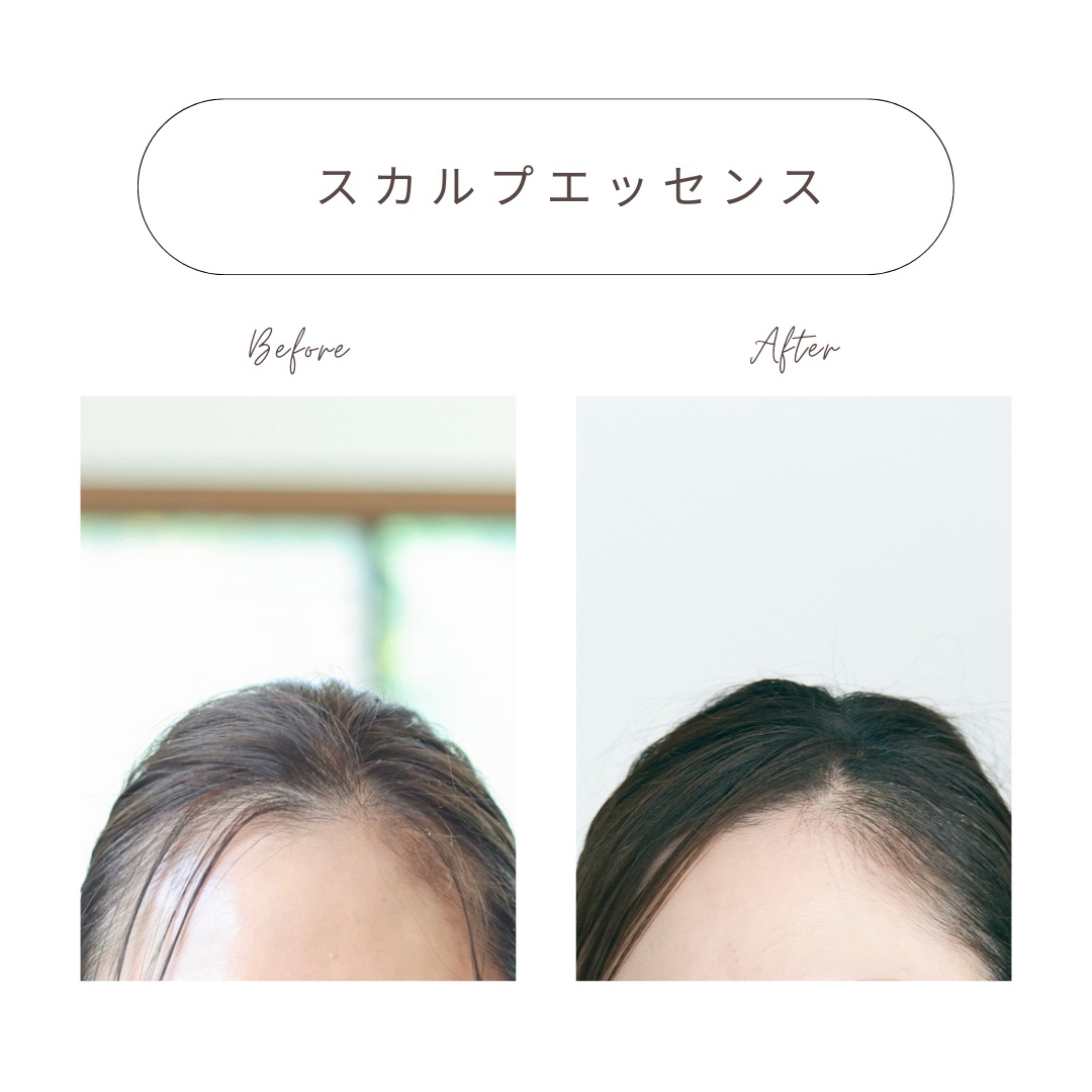 資生堂プロフェッショナル / ザ・ヘアケア アデノバイタル スカルプ